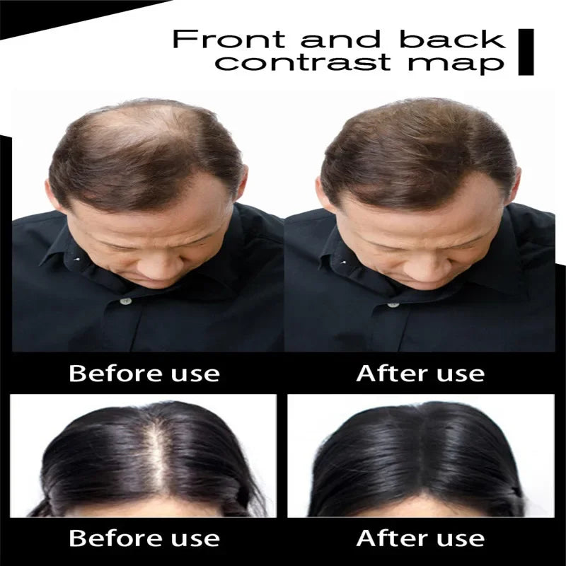 Original Hair fibers Keratin Thickening Spray Hair Growth Powder Wig Regrowth For Woman Man Hair Building Fibers Loss Product